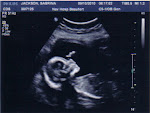 Baby Jackson