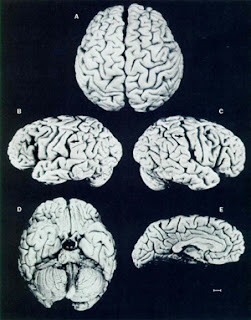 http://1.bp.blogspot.com/_jhHww-4X9DY/TPhjfvUAshI/AAAAAAAAAMg/t0Z75ilTi0M/s320/Einstein+brain+in+1955.jpg