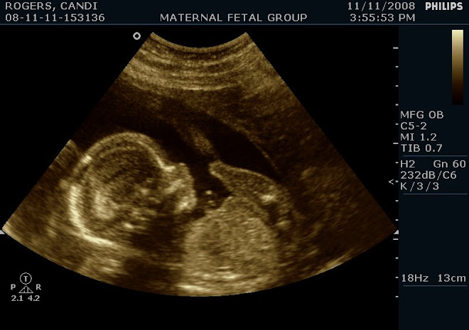 TAYLOR QUINN - 20 WEEKS