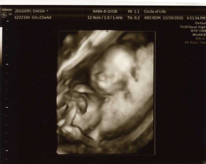 Jeffery Family 22 Weeks 4 Days! Targeted Ultrasound... Yay!