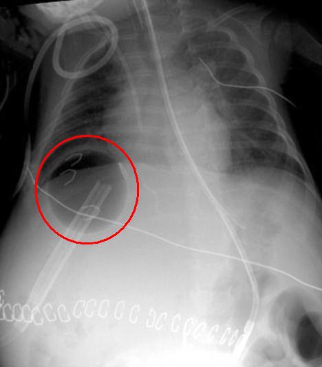 [Ping+pong+ball+X-ray.jpg]