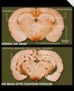 CERVEAU DU MÊME RAT! AVANT ET APRÈS QUOI?