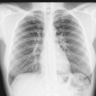 [Raio_x_TORAX_web.jpg]