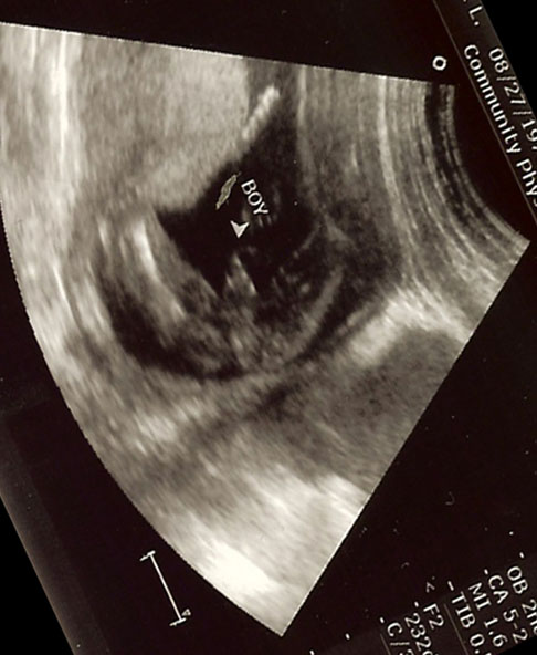 [ultrasound+boy-rotated.jpg]