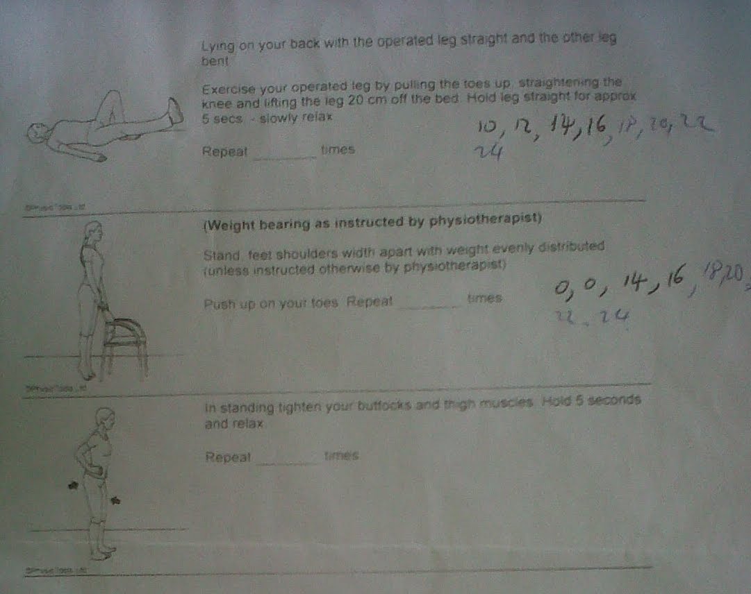 Plica Syndrome Symptoms