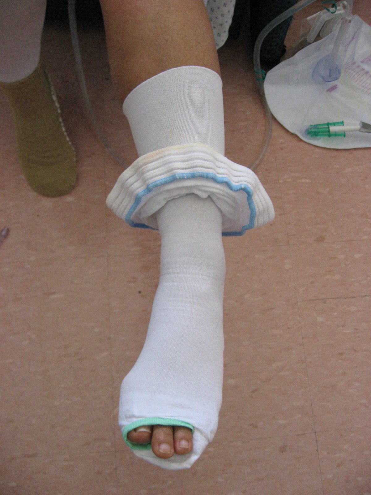 [Post-Surgery080908_050.JPG]
