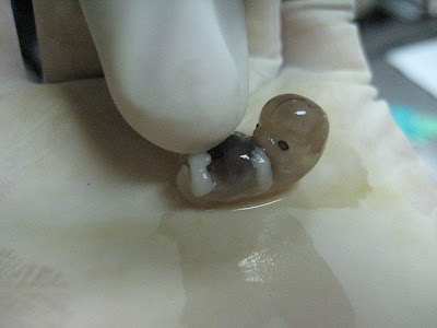 "Si la mujer aborta, el varn puede abusar de ella" - Pgina 5 Embrion+6+semanas