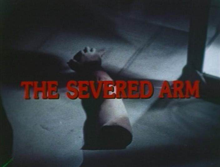 100 Rayguns 14. The Severed Arm 1973