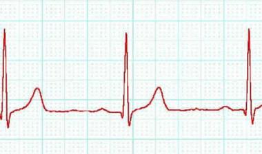 [cardiograph_270808.jpg]