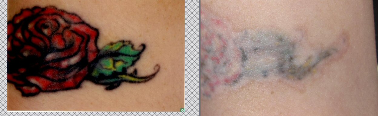Bleeding Ink Tattoo