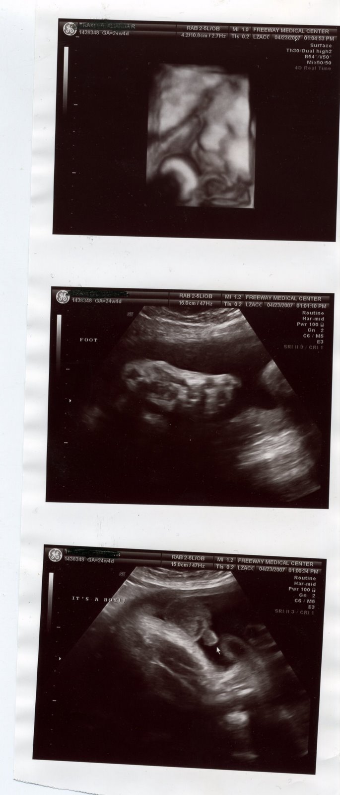 [ultrasound+2.jpg]