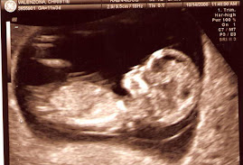 Our baby girl at 20 weeks!
