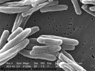 [Mycobacterium-tuberculosis.jpg]