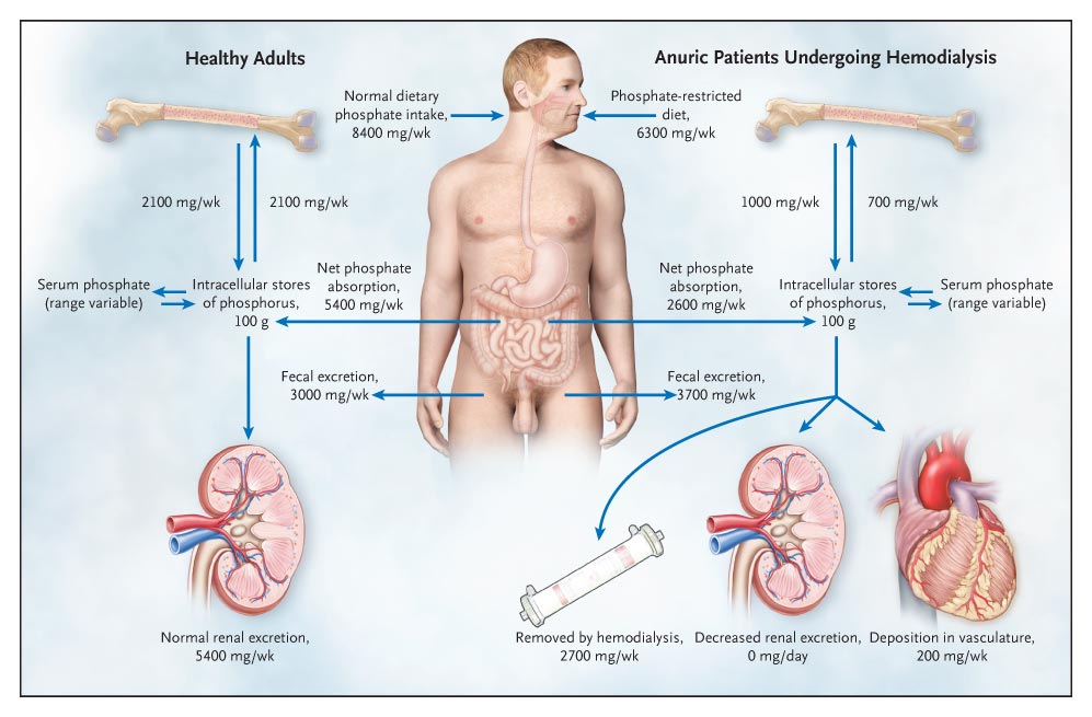 Phimaimedicine 470. Oral phosphate binders in patients with kidney failure