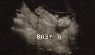 Here's Baby A!