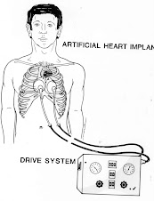 Dr. Jarvik's Heart