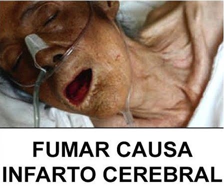Ha dejado a beber duele la cabeza siempre