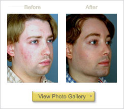 [mandibular-bef-after.jpg]