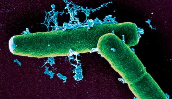 [anthrax-bacteria.jpg]