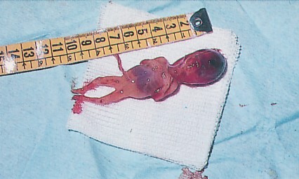 nadie tendria que sorprender el de la foto de la izquierda es un bebe