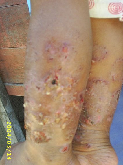 [Nurmila_Paparo.jpg]