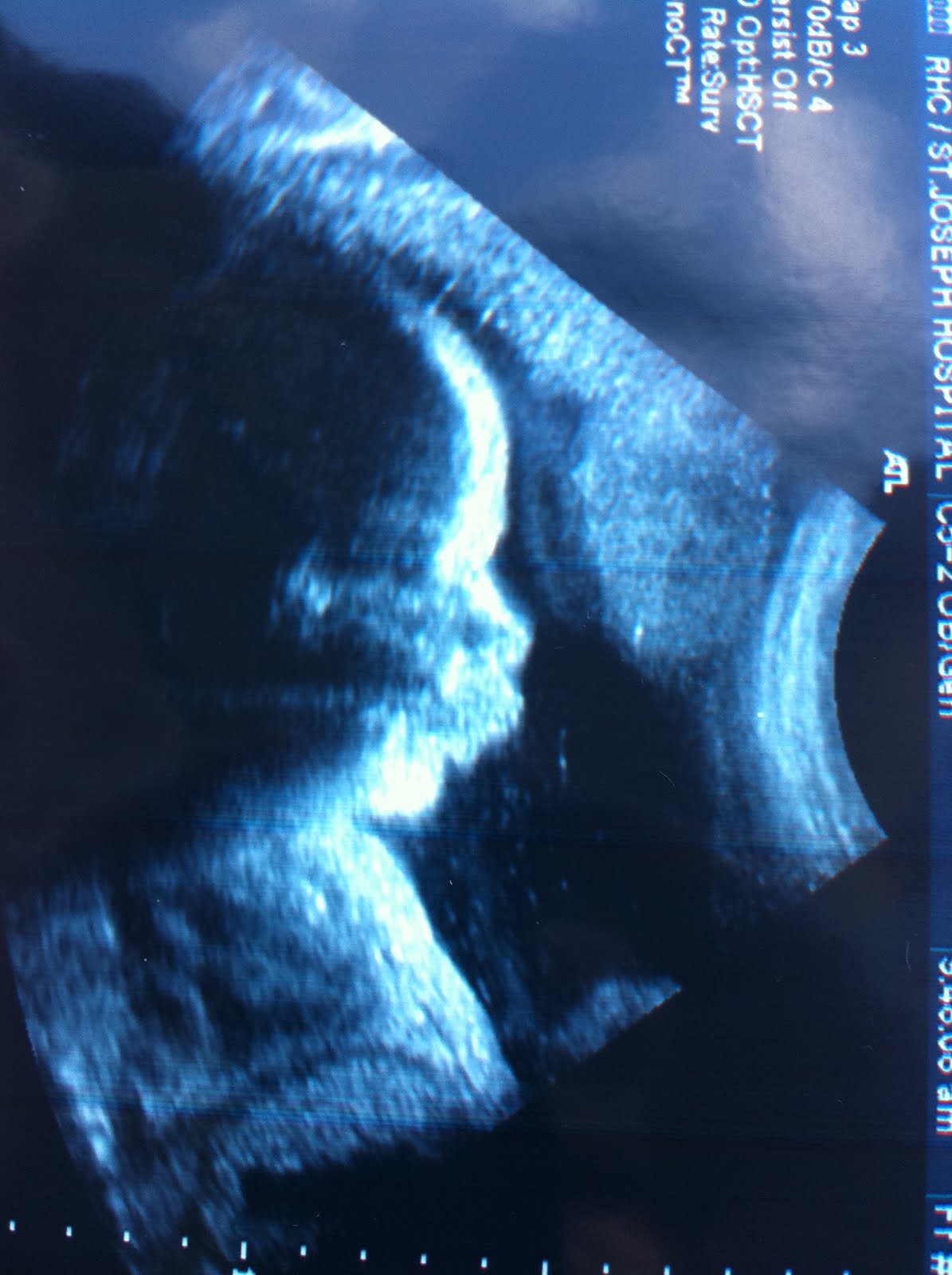 Pretty Little Things Cute Funny Baby 34 Week Ultrasound