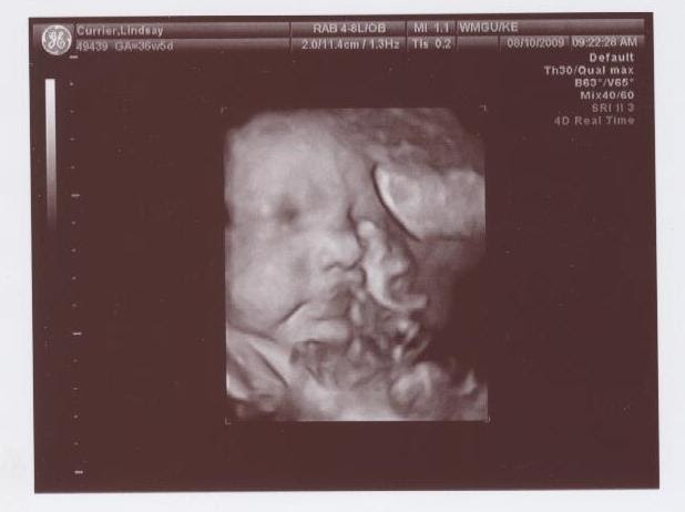 The Currier Family 37 Week 3d Ultrasound