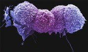 Lung Cancer Cell