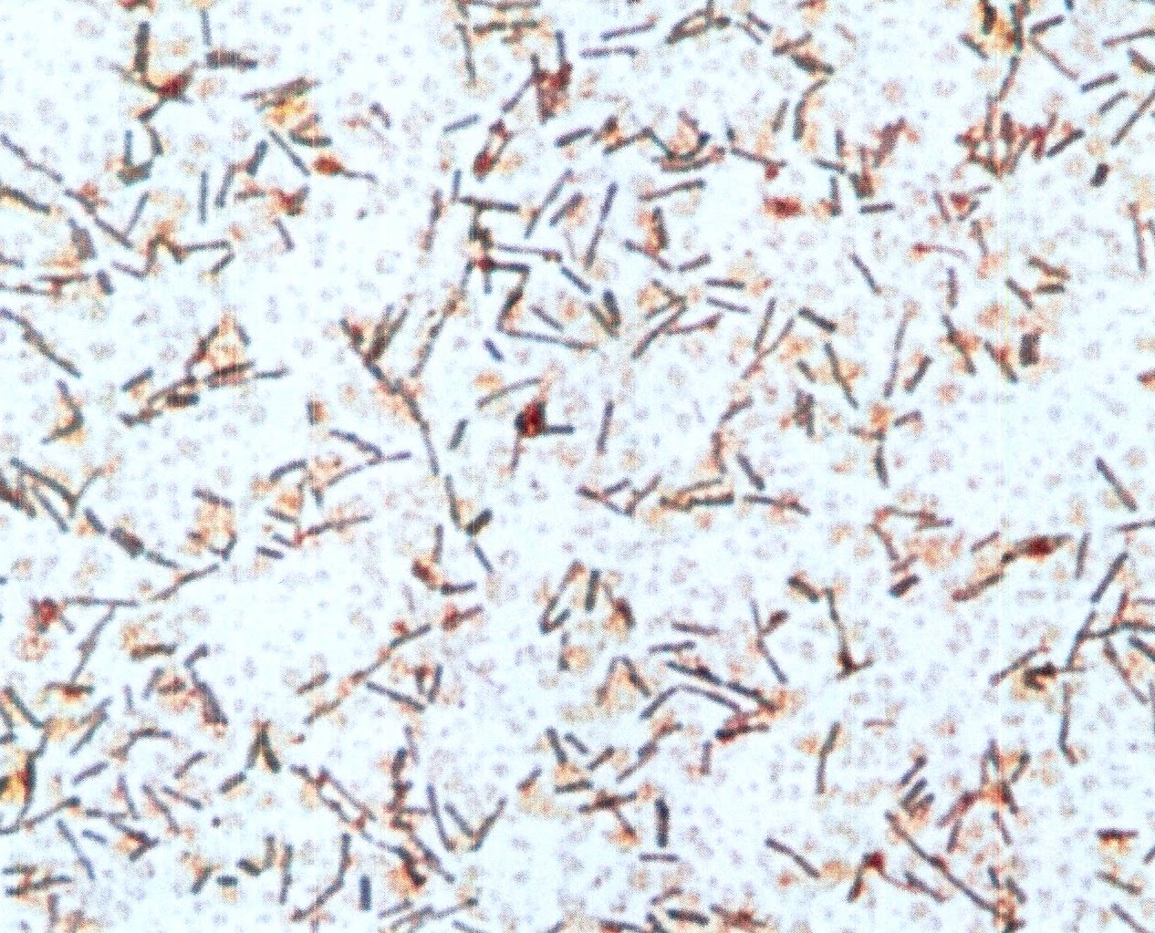 bacillus stain