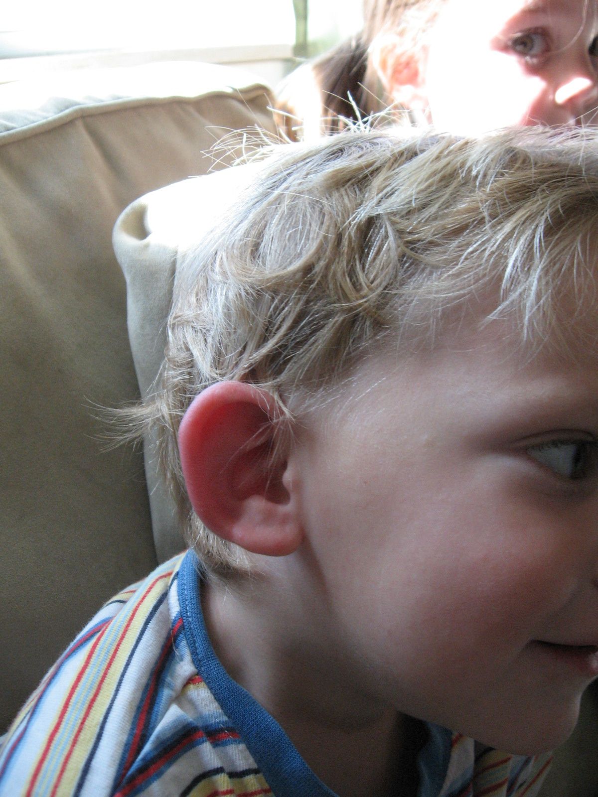 Swollen Ears