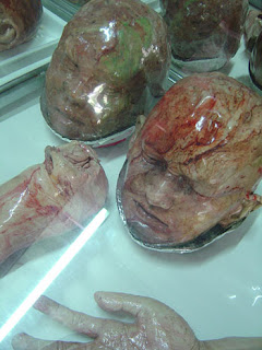 Verge of Existence: Human Body Parts for Sale