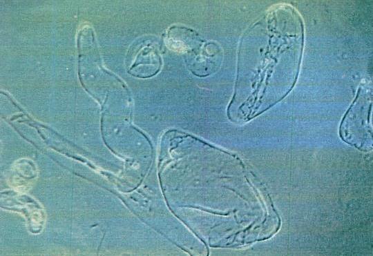 Micrograph of certain plant cells growing in test tubes: size 100 mm milliseconds