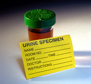 [urine_sample_pd.jpg]