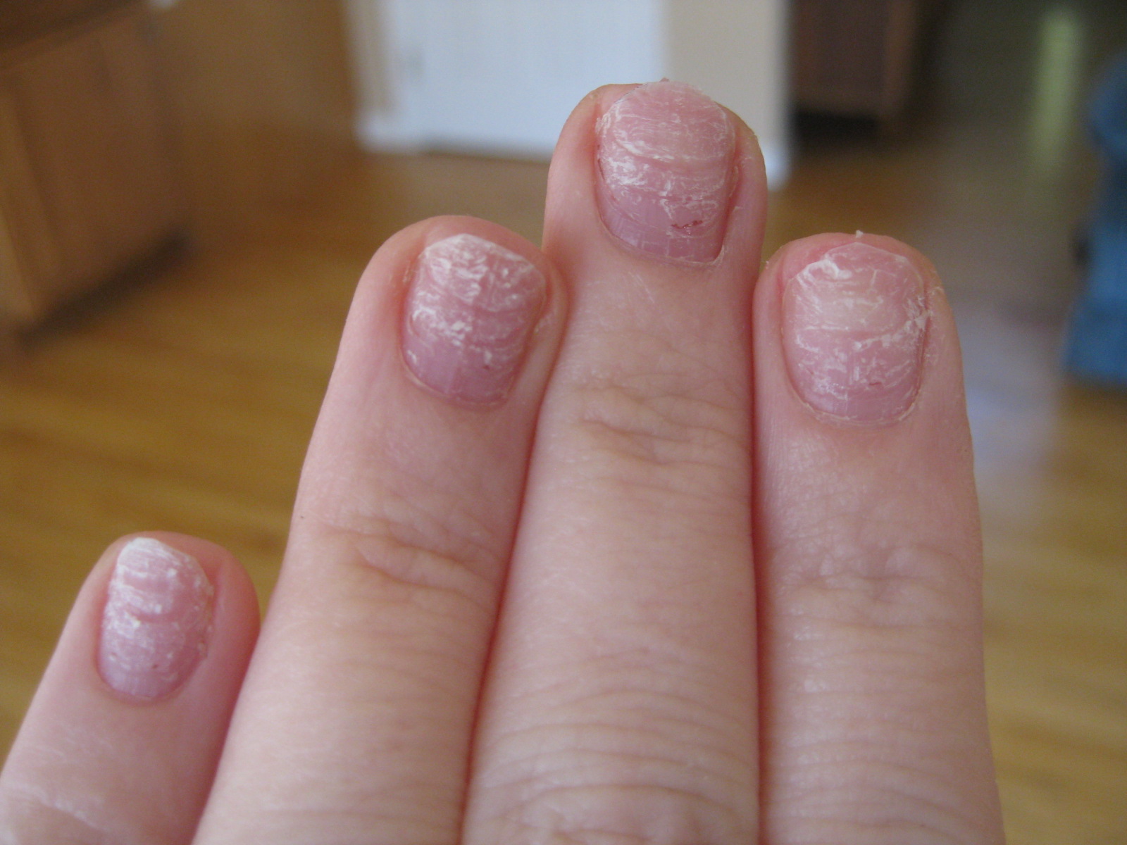 Short+stubby+nails