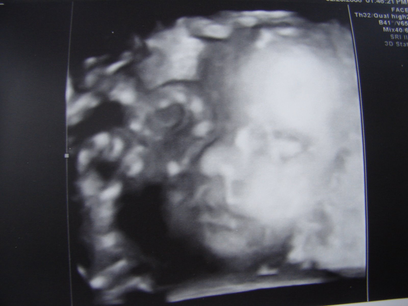 [budge+and+fetus+016.JPG]