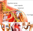 Here are just a few simple and natural ways to relieve arthritis pain in Diet To Relieve Arthritis Pain