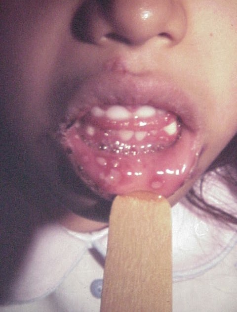 Pop rocks and oral sex photos 60