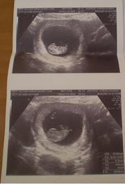 A Princesa às 12 Semanas