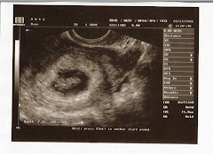 First Baby Pic, March 17th