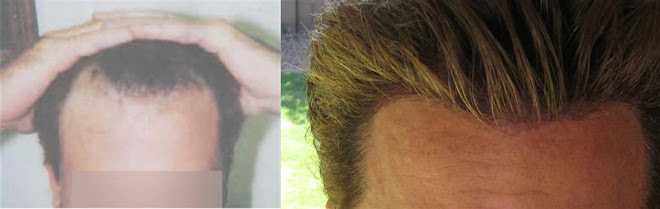 Comparison Photos