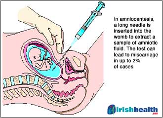Figure 1 From Prenatal Diagnosis Of Transient Abnormal