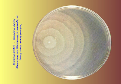 اطلس الميكروبيولوجي -1- 2_Proteus+Swarming+growth