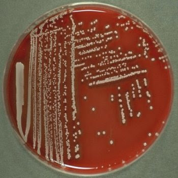 اطلس الميكروبيولوجي -1- No+haemolysis