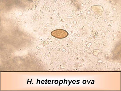 اطلس الطفيليات -1- H.+heterophyes