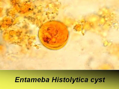 اطلس الطفيليات -1- E.+histolytica