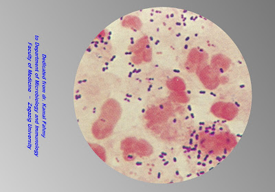 اطلس الميكروبيولوجي -1- Pneumococci+in+sputum