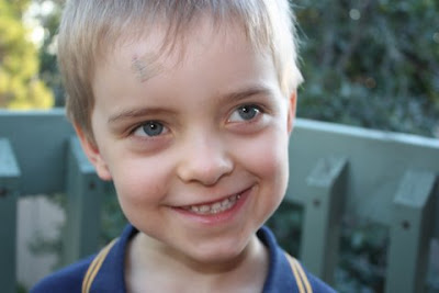 Cut Forehead