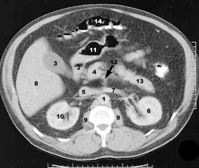 CT PHYSICS 09: Cross-sectional CT images of the abdomen