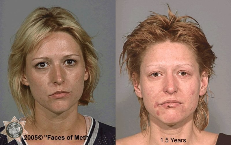 Faces+of+Meth+¬+2005+F18.jpg