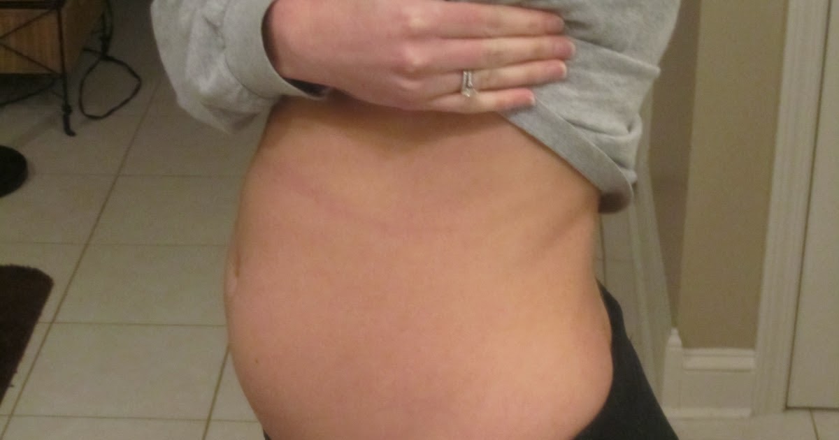 ...and then there were three: 20 Weeks